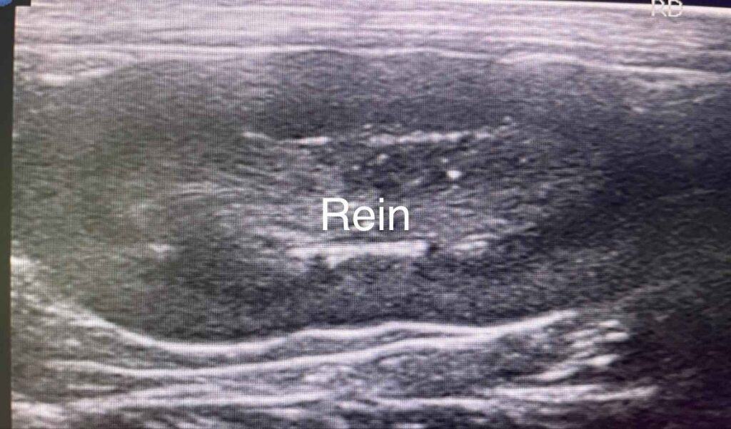 Échographie montrant le rein d'un lapin